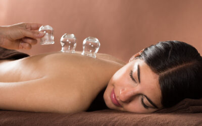 Cupping Could Be the Key to Improved Fertility