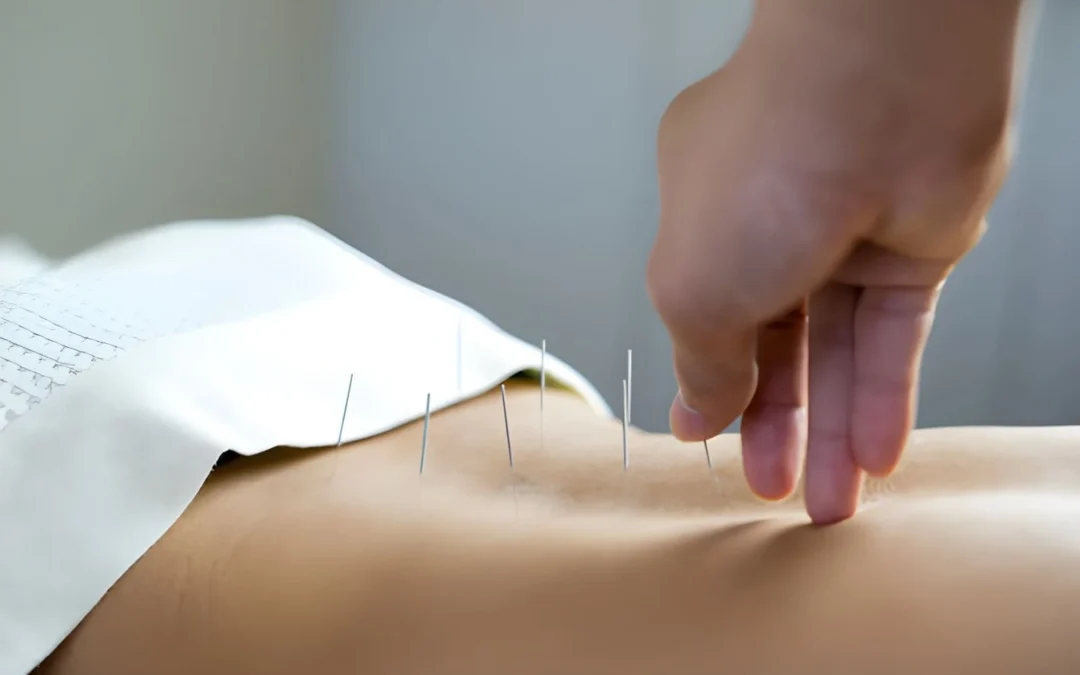 acupuncture for hormonal imbalance