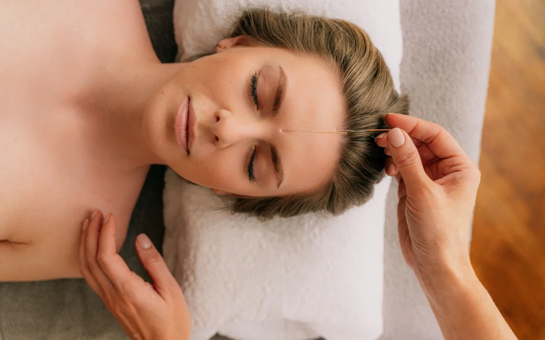 Facial Acupuncture Rejuvenation: A Natural Approach