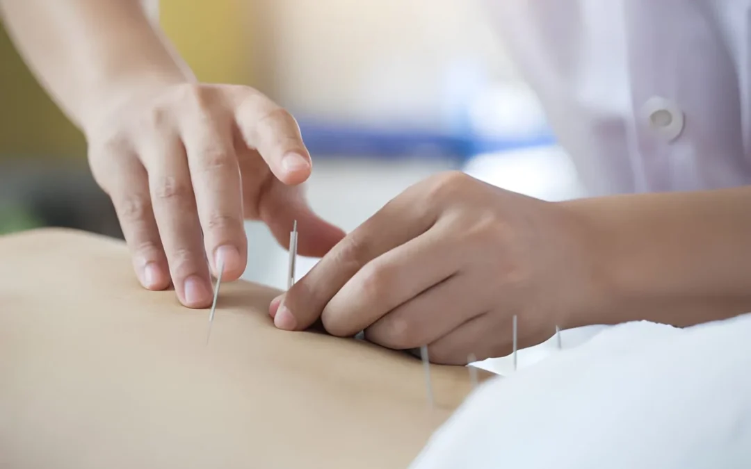 fertility acupuncture near me