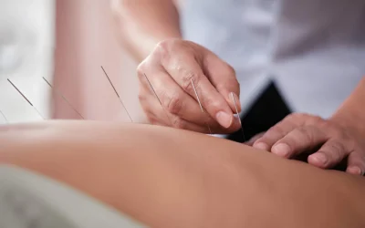 How Does Acupuncture Help Fertility? A Compassionate Guide